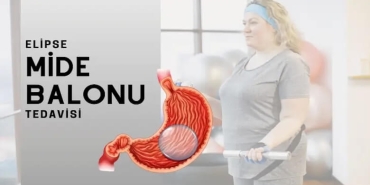 Mide Balonu Taktıranlar