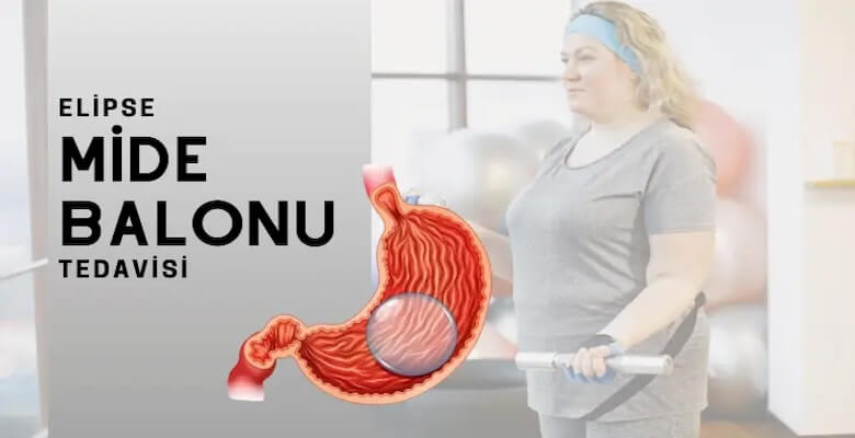 Mide Balonu Taktıranlar