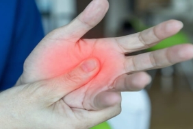 Karpal Tünel Sendromu: Belirtileri, Tanı Yöntemleri ve MR Nörografinin Rolü