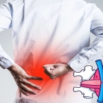 Uzun Süre Masa Başında Oturmak Bel Fıtığı Ameliyatı Riskini Artırır mı?