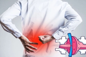 Uzun Süre Masa Başında Oturmak Bel Fıtığı Ameliyatı Riskini Artırır mı?