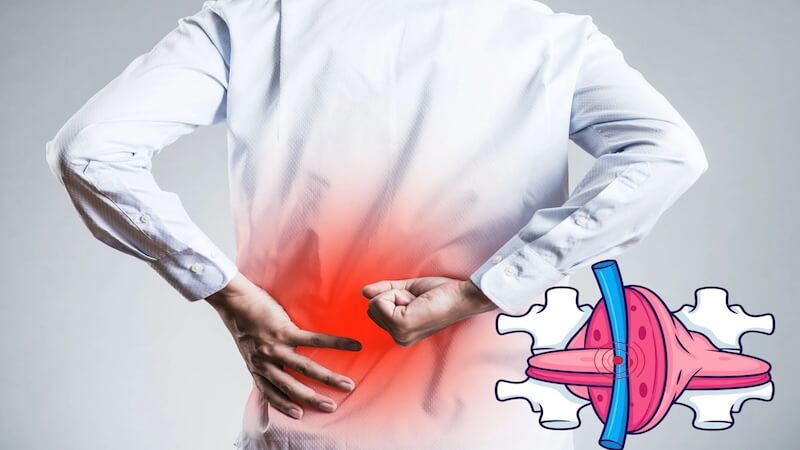 Uzun Süre Masa Başında Oturmak Bel Fıtığı Ameliyatı Riskini Artırır mı?